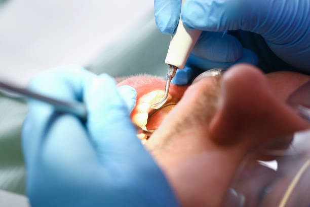 Fast & Reliable Emergency Dental Services in AL
