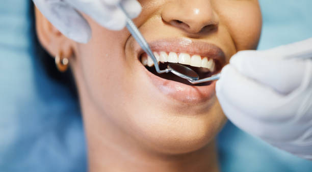 Best Emergency Broken Tooth Repair in Dauphin Island, AL